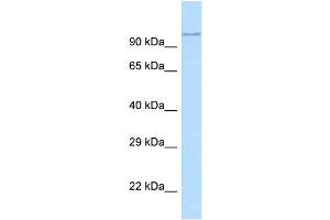 WB Suggested Anti-Adam29 Antibody   Titration: 1. (ADAM29 anticorps  (N-Term))