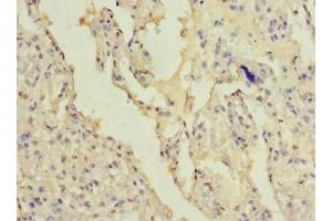 Immunohistochemistry of paraffin-embedded human lung tissue using ABIN7165382 at dilution of 1:100 (FAM124B anticorps  (AA 146-272))