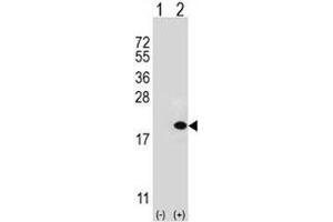 Western blot analysis of UBE2V1 antibody and 293 cell lysate (2 ug/lane) either nontransfected (Lane 1) or transiently transfected (2) with the UBE2V1 gene. (UBE2V1 anticorps  (AA 113-145))