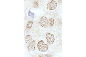 Immunohistochemistry (IHC) image for anti-SSB1 (AA 161-211) antibody (ABIN7448816) (SSB1 (AA 161-211) anticorps)
