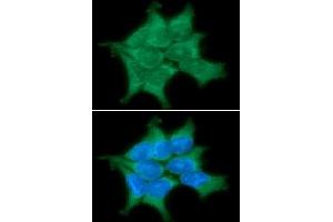 ICC/IF analysis of PPM1G in 293T cells line, stained with DAPI (Blue) for nucleus staining and monoclonal anti-human PPM1G antibody (1:100) with goat anti-mouse IgG-Alexa fluor 488 conjugate (Green) (PPM1G anticorps)