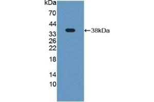 Detection of Recombinant Plg, Rat using Polyclonal Antibody to Plasminogen (Plg)