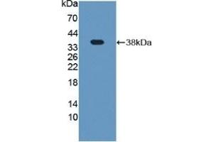 Detection of Recombinant Plg, Rat using Polyclonal Antibody to Plasminogen (Plg) (PLG anticorps  (AA 191-433))
