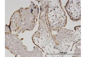 Image no. 4 for anti-Helicase with Zinc Finger (HELZ) (AA 1-101) antibody (ABIN599500) (HELZ anticorps  (AA 1-101))