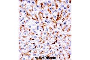 Immunohistochemistry (IHC) image for anti-Mitogen-Activated Protein Kinase 11 (MAPK11) antibody (ABIN2997621) (MAPK11 anticorps)