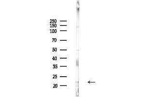 anti-SIVA1, Apoptosis-Inducing Factor (SIVA1) (Internal Region) antibody