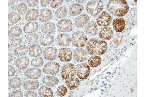 IHC-P Image Immunohistochemical analysis of paraffin-embedded human small intestine, using MST4, antibody at 1:100 dilution.