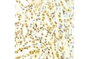 Immunohistochemistry of paraffin-embedded human kidney using DKC1 Antibody (ABIN5970956) at dilution of 1/100 (40x lens). (DKC1 anticorps)