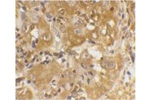 Image no. 1 for anti-BCL2-Like 11 (Apoptosis Facilitator) (BCL2L11) (Internal Region) antibody (ABIN201915) (BIM anticorps  (Internal Region))