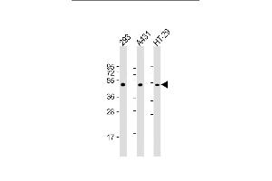 All lanes : Anti-p53 Antibody (S15) at 1:2000 dilution Lane 1: 293 whole cell lysate Lane 2: A431 whole cell lysate Lane 3: HT-29 whole cell lysate Lysates/proteins at 20 μg per lane.