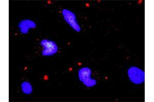 Proximity Ligation Analysis of protein-protein interactions between TRAF2 and ERN1. (ERN1 anticorps  (AA 401-500))