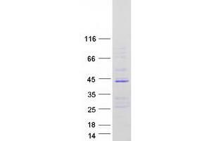 Validation with Western Blot (MBNL3 Protein (Transcript Variant R) (Myc-DYKDDDDK Tag))