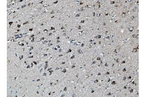 IHC analysis of MEK2/MAP2K2 using anti-MEK2/MAP2K2 antibody (ABIN7599357).