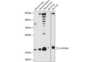 Western blot analysis of extracts of various cell lines, using SH3BGRL antibody (ABIN7270277) at 1:1000 dilution. (SH3BGRL anticorps  (AA 1-114))