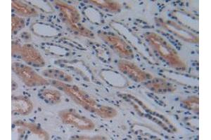 Detection of COX-1 in Human Kidney Tissue using Polyclonal Antibody to Cyclooxygenase 1 (COX-1) (COX-1 anticorps  (AA 367-599))