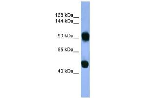 WB Suggested Anti-AP1B1 Antibody Titration: 0. (AP1B1 anticorps  (C-Term))