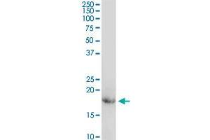 CD247 MaxPab rabbit polyclonal antibody. (CD247 anticorps  (AA 1-164))