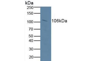 Figure. (Retinoblastoma 1 anticorps  (AA 639-778))