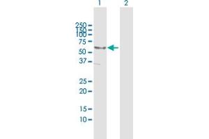 Western Blot analysis of DNAJC7 expression in transfected 293T cell line by DNAJC7 MaxPab polyclonal antibody.