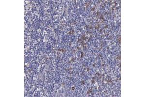 Immunohistochemical staining of human tonsil with ZC3H12B polyclonal antibody  shows distinct cytoplasmic positivity in subsets of cells. (ZC3H12B anticorps)