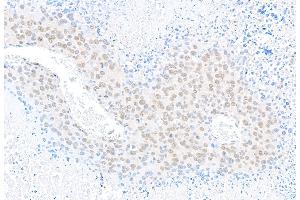 anti-U2 Small Nuclear RNA Auxiliary Factor 1 (U2AF1) (AA 140-190) antibody
