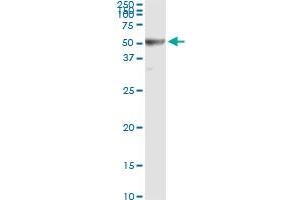 Immunoprecipitation of RRM2 transfected lysate using anti-RRM2 monoclonal antibody and Protein A Magnetic Bead , and immunoblotted with RRM2 MaxPab rabbit polyclonal antibody.