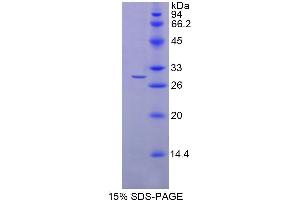 SDS-PAGE analysis of Human NAAA Protein. (NAAA Protéine)