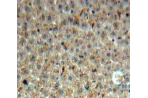 Used in DAB staining on fromalin fixed paraffin-embedded Liver tissue