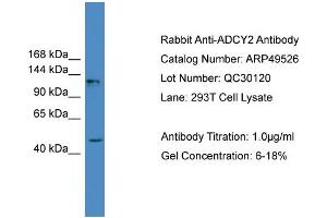 WB Suggested Anti-ADCY2  Antibody Titration: 0. (ADCY2 anticorps  (Middle Region))