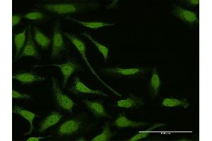 Immunofluorescence of purified MaxPab antibody to LIMK1 on HeLa cell.