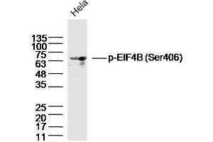 HeLa lysates probed with EIF4B (Ser406) Polyclonal Antibody, Unconjugated  at 1:300 dilution and 4˚C overnight incubation. (EIF4B anticorps  (pSer406))