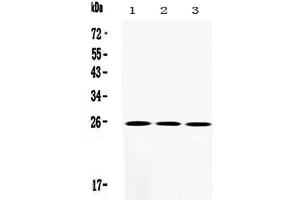 Western blot analysis of SOD2/Mnsod using anti-SOD2/Mnsod antibody . (SOD2 anticorps  (N-Term))