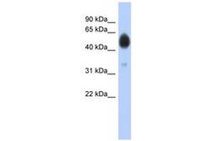 Image no. 1 for anti-Arylsulfatase A (ARSA) (AA 37-86) antibody (ABIN6743778) (Arylsulfatase A anticorps  (AA 37-86))