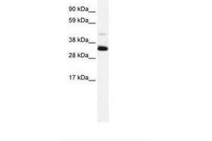 Image no. 2 for anti-Annexin A3 (ANXA3) (N-Term) antibody (ABIN202243) (Annexin A3 anticorps  (N-Term))