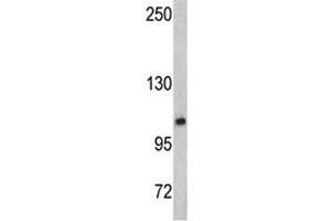 Western blot analysis of OGT antibody and mouse bladder tissue lysate
