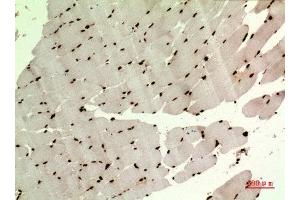 Immunohistochemistry (IHC) analysis of paraffin-embedded Human Muscle, antibody was diluted at 1:100.