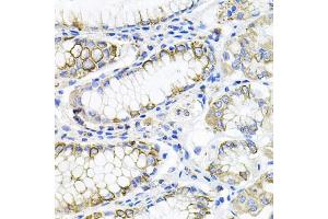 Immunohistochemistry of paraffin-embedded human stomach using ACVR2A antibody (ABIN5971030) at dilution of 1/100 (40x lens). (ACVR2A anticorps)