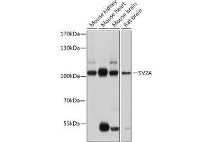Western blot analysis of extracts of various cell lines, using SV2A antibody (ABIN7270665) at 1:1000 dilution. (SV2A anticorps  (AA 356-447))