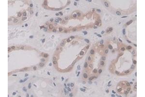 Detection of ANXA11 in Human Kidney Tissue using Polyclonal Antibody to Annexin A11 (ANXA11)
