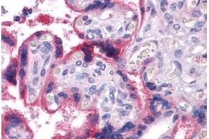 Placenta, Human: Formalin-Fixed, Paraffin-Embedded (FFPE)