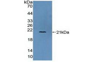 Detection of Recombinant COL6a3, Human using Polyclonal Antibody to Collagen Type VI Alpha 3 (COL6a3) (COL6a3 anticorps  (AA 463-624))