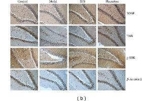 Representative Western blot analysis (a) and immunohistochemical staining (b) of BDNF, TrkB, p-ERK, ERK, and β-arrestin 2 in the hippocampus.