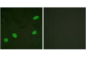 Immunofluorescence analysis of HeLa cells, using ATRIP (Ab-68/72) Antibody. (ATRIP anticorps  (AA 34-83))
