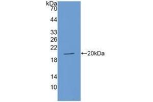 Detection of Recombinant ACE, Human using Polyclonal Antibody to Angiotensin I Converting Enzyme (ACE) (Angiotensin I Converting Enzyme 1 anticorps  (AA 1160-1306))