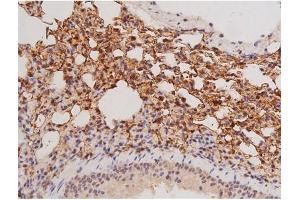 ABIN6269133 at 1/200 staining Mouse lung tissue sections by IHC-P. (KIT anticorps  (Internal Region))