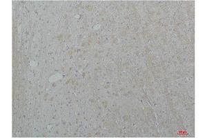 Immunohistochemistry (IHC) analysis of paraffin-embedded Rat Brain Tissue using Cav2.