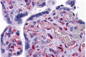 Human Placenta: Formalin-Fixed, Paraffin-Embedded (FFPE) (EFCAB4B anticorps  (C-Term))