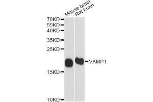 Western blot analysis of extracts of various cell lines, using VAMP1 antibody. (VAMP1 anticorps  (AA 1-96))
