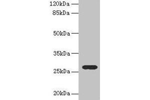 Western blot All lanes: TEX35 antibody at 4 μg/mL + U251 whole cell lysate Secondary Goat polyclonal to rabbit IgG at 1/10000 dilution Predicted band size: 27, 26, 24, 21, 25 kDa Observed band size: 27 kDa (TEX35 anticorps  (AA 1-215))
