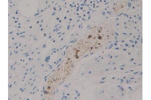 DAB staining on IHC-P; Samples: Human Stomach Tissue (DGKZ anticorps  (AA 695-932))